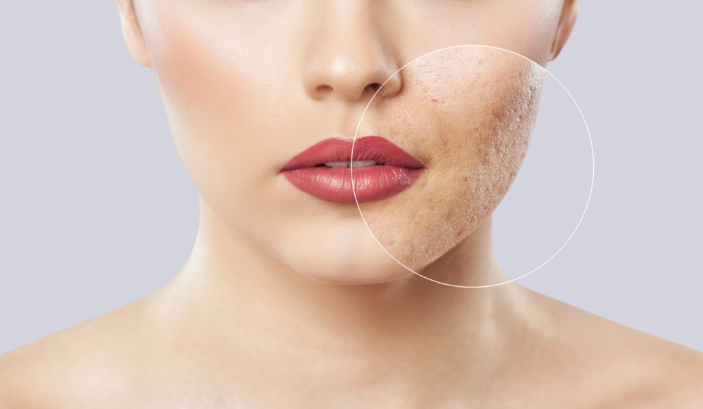 skin treatments | Savvy chic
