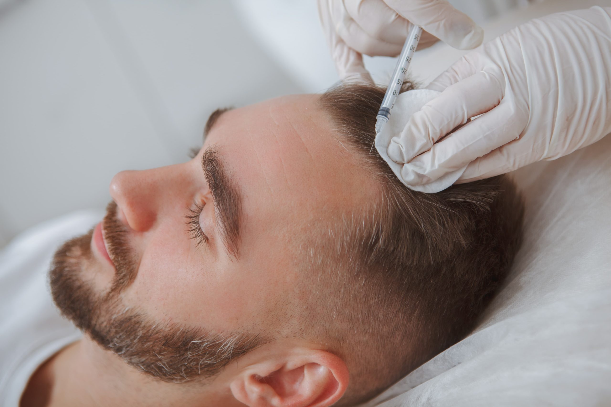 What is Better, a Hair Transplant or PRP?